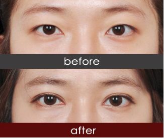 四川美容整形機(jī)構(gòu)哪家好？全方位評比四川最佳美容整形機(jī)構(gòu)排行榜