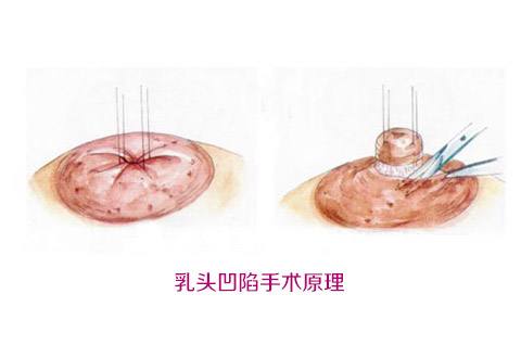 沈陽百嘉麗醫(yī)院之汪曉蕾：她的醫(yī)療造詣如何？