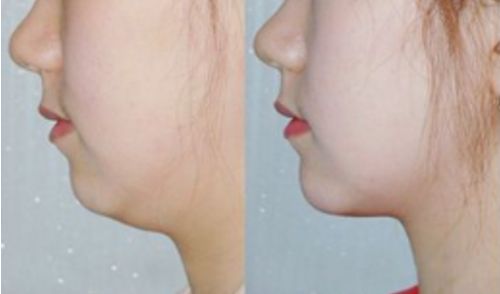 山東臨沂整容醫(yī)院排行榜及綜合評(píng)價(jià)：哪家好？