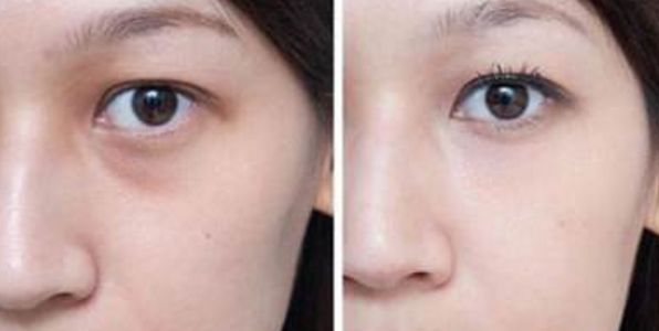 重慶修復(fù)疤痕哪家醫(yī)院好？專業(yè)推薦重慶治療疤痕效果好的醫(yī)院