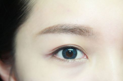 寧波哪家醫(yī)院割雙眼皮效果好？