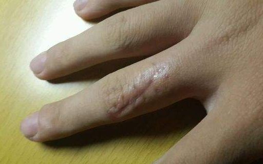 上海哪家醫(yī)院做肋骨鼻子整形手術(shù)好？