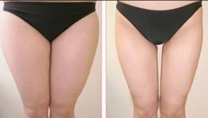 如何評(píng)價(jià)廣州珈禾整形醫(yī)院的口碑和質(zhì)量？