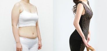 成都做雙眼皮，哪家醫(yī)院專業(yè)可靠？