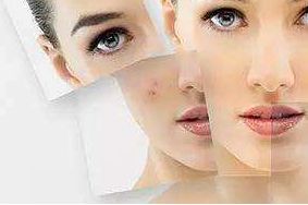 上海哪家醫(yī)院祛太田痣效果最佳？