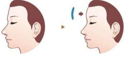 上海第九醫(yī)院整形科名醫(yī)推薦，詳細介紹、價格查詢及周邊導(dǎo)航