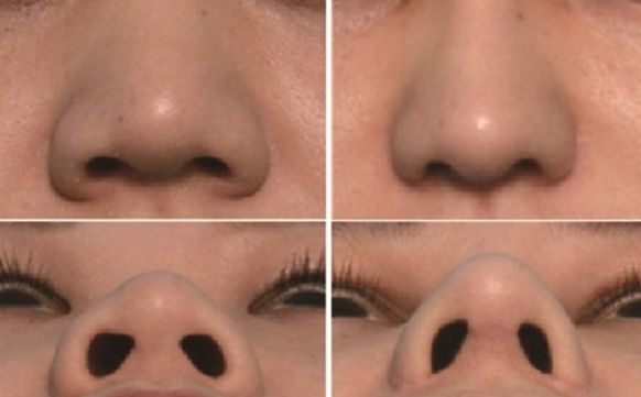 湖州市哪家醫(yī)院去疤痕好？專家推薦疤痕修復(fù)技術(shù)排行榜！