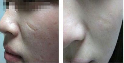 湖北棗陽整形醫(yī)院哪家最值得信賴？