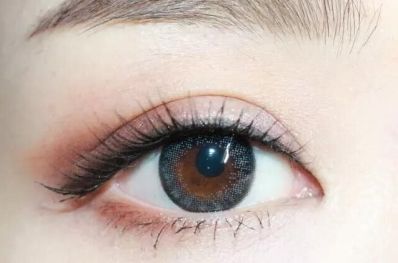 如何選擇德陽切開雙眼皮專家？評(píng)估這些因素找到最好的醫(yī)院！