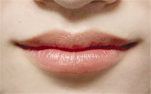 2023大連小切口祛除面部皺紋醫(yī)生TOP10強(qiáng)上榜名單(秦宏智、沈文強(qiáng)、李輝當(dāng)?shù)爻雒孔V的醫(yī)美)