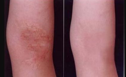 重慶整形醫(yī)院哪家效果好？權(quán)威排行榜來(lái)告訴你！