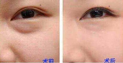 杭州整形美容界大咖PK，曾海峰、河?xùn)|鎬、高俊明，想知道磨骨哪個(gè)醫(yī)生靠譜？