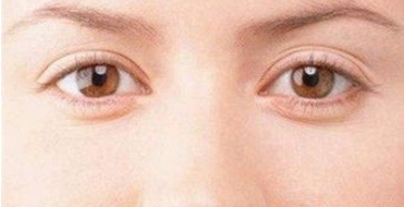 杭州整形美容行業(yè)對做鼻子的需求熱度居高不下，哪家醫(yī)院的技術(shù)更靠譜？費用參考！