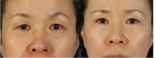 南京硅膠隆鼻哪家醫(yī)院好？斯景醫(yī)療專家推薦！