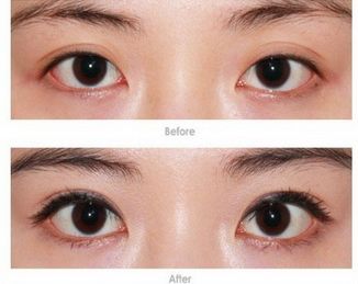 武漢處女膜修復(fù)哪家好？專業(yè)修復(fù)機(jī)構(gòu)推薦詳細(xì)比較