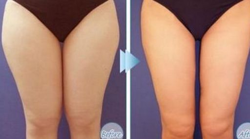 哪位醫(yī)生在北京八大處做拉皮手術(shù)效果好？馬繼光的資歷和費(fèi)用情況有哪些？