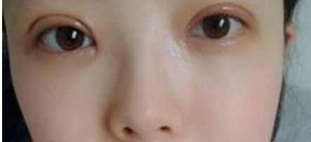 重慶隆鼻整形排名前三的醫(yī)院有哪些？