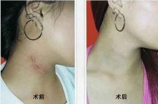 南寧哪家醫(yī)院治痘效果好？選擇明星們的美肌秘密推薦的南寧優(yōu)質(zhì)醫(yī)院