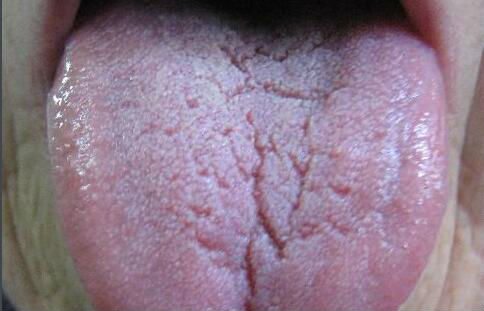 2023湛江溶脂去眼袋手術top10強醫(yī)生(朱本谷、趙璽耀、張俊優(yōu)質(zhì)醫(yī)美價格公道)