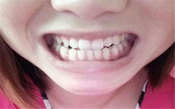 2023無錫水動(dòng)力360°環(huán)形吸脂權(quán)威專家排名前10位(張若梅、余海龍、任天平入圍)