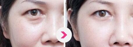 北京哪位醫(yī)生擅長巨乳縮小手術(shù)？5名實(shí)力醫(yī)生值得推薦