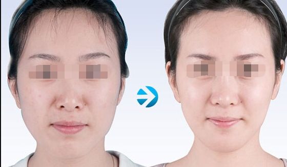 蘇州哪家吸脂好又實(shí)惠？專業(yè)美容機(jī)構(gòu)為您推薦