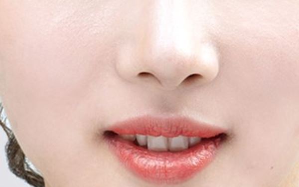 東莞市人民醫(yī)院劉玉生面部整形術(shù)效果如何？