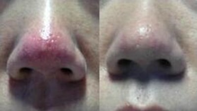 福州哪家醫(yī)生做隆胸技術(shù)好？推薦五位專業(yè)醫(yī)師，價格參考！