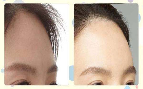 全國整容醫(yī)生PHD公開名單，創(chuàng)新技術(shù)行業(yè)新標(biāo)桿