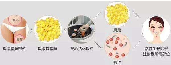 哈爾濱哪家醫(yī)院的去皺針效果好？