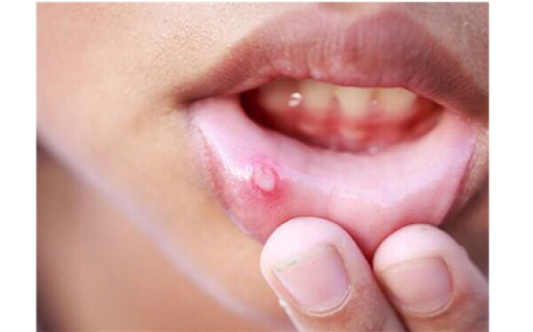 2023陜西雙下巴射頻溶脂權(quán)威醫(yī)生評價(jià)前十位(孫要文、張菊芳、張永實(shí)力值得信賴，價(jià)格還特優(yōu)惠)