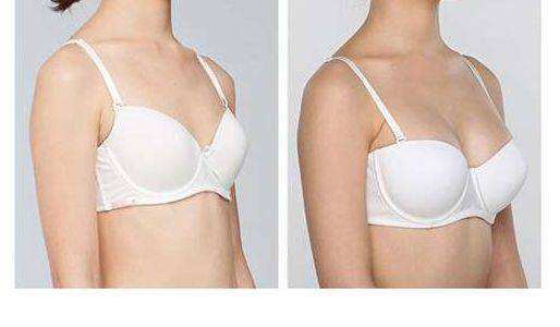 2023湖州激光去頸紋手術(shù)專家排名前十名(王克東、魏敬想、榮崢放心選不踩坑)