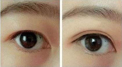 合肥哪家整形醫(yī)院好口碑好服務(wù)好值得推薦？