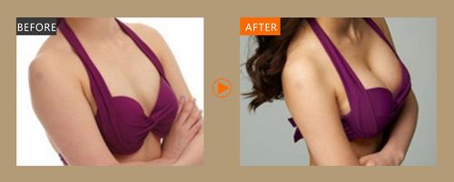 2023合肥鼻唇溝注射肉毒素權(quán)威專(zhuān)家排行前十強(qiáng)(高嫣、李明、趙雅玲榜一優(yōu)先登頂)