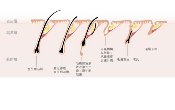 深圳哪家激光祛斑醫(yī)院口碑好？
