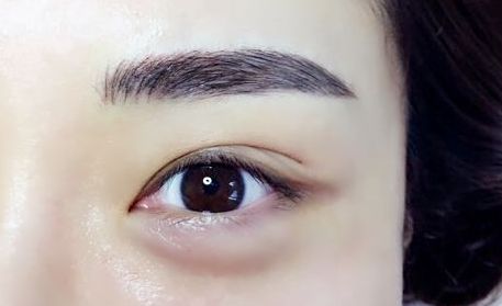 北京整形外科醫(yī)院排名及評(píng)價(jià)，推薦哪家整形醫(yī)院效果好