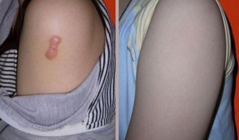 西安市哪家醫(yī)院整容效果好，值得信賴？