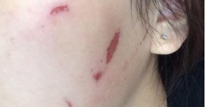 石家莊雅芳亞醫(yī)療美容醫(yī)院的醫(yī)院簡介及醫(yī)生資料是什么？