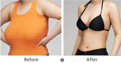 深圳雙眼皮修復(fù)哪家好？機(jī)構(gòu)排名及評(píng)價(jià)調(diào)查報(bào)告