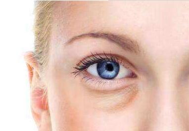 張娟醫(yī)生做雙眼皮術(shù)效果如何？