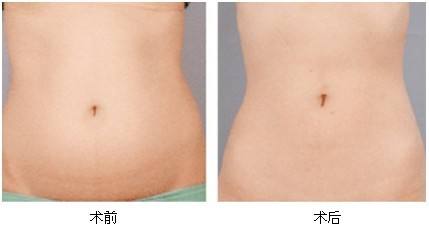 2023湘潭彩光美白嫩膚專家前10位排行榜(劉佑文、熊宜文、熊志能幫你圓夢)