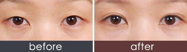 西安哪家美容醫(yī)院口碑好，專業(yè)評測推薦？