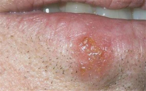 2023新疆水光針祛除唇紋醫(yī)生排行榜前十強(qiáng)(張傳功、李朝陽、張偉詳細(xì)資料)