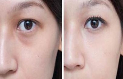 上海整形私密醫(yī)院排名及口碑，哪家好？