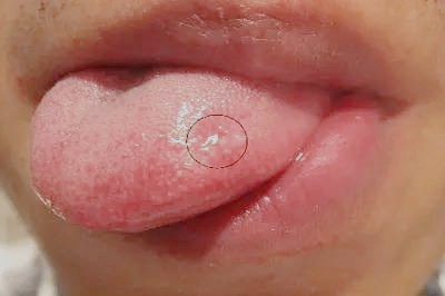 2023駐馬店E光美白治療前10名專家排行榜(王廣東、王小林、關(guān)鵬憑實(shí)力入圍，口碑不錯!)