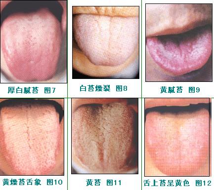 2023通遼下眼袋吸脂肪前10名專家強(qiáng)榜(李笙明、王雪艷、賴炳文優(yōu)勢顯著)