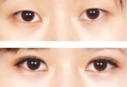 榆林市美容哪家醫(yī)院好？榆林市頂級美容醫(yī)院推薦