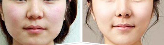 廣西哪家整形美容科醫(yī)院值得選擇？