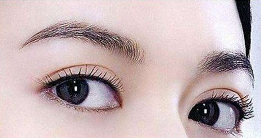 深圳哪家醫(yī)院的雙眼皮手術(shù)效果好？