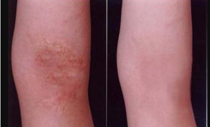 河北雙眼皮手術(shù)哪家好？挑選專(zhuān)業(yè)技術(shù)與良好口碑并存的醫(yī)療機(jī)構(gòu)！